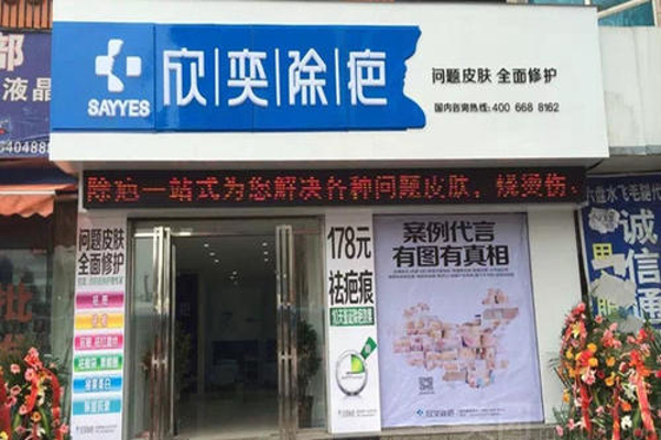 欣奕除疤加盟费
