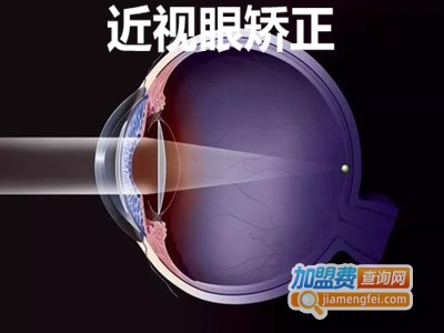 近视眼矫正加盟