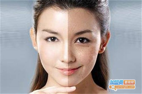 爱美诚祛斑加盟费