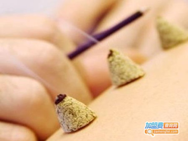 艾隆力艾灸加盟费