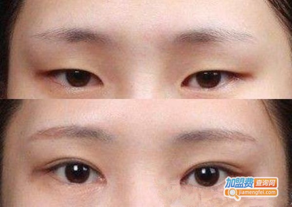 星范整形美容加盟费
