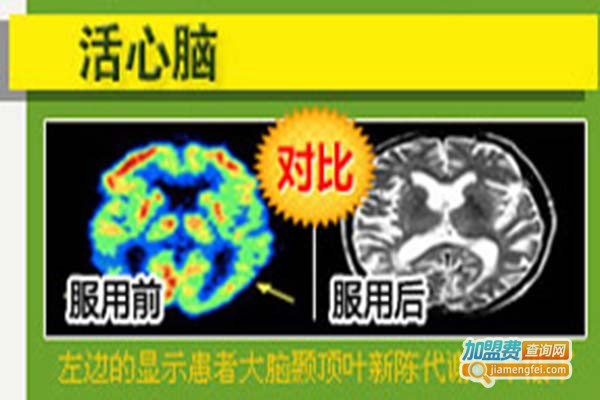 唐乐膳保健茶加盟费