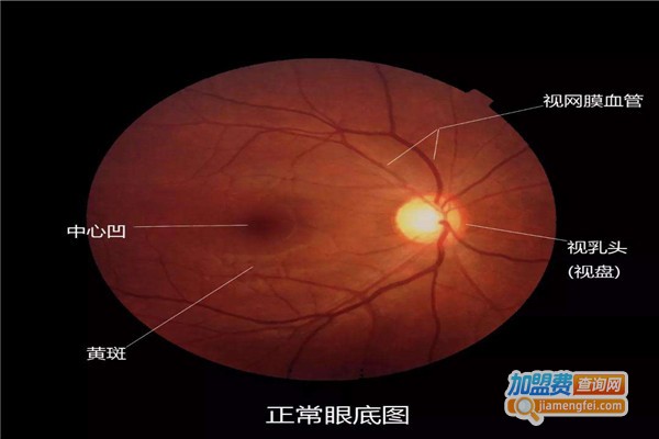 中科视康视恢加盟费