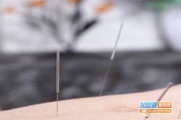 王立新小儿推拿加盟费