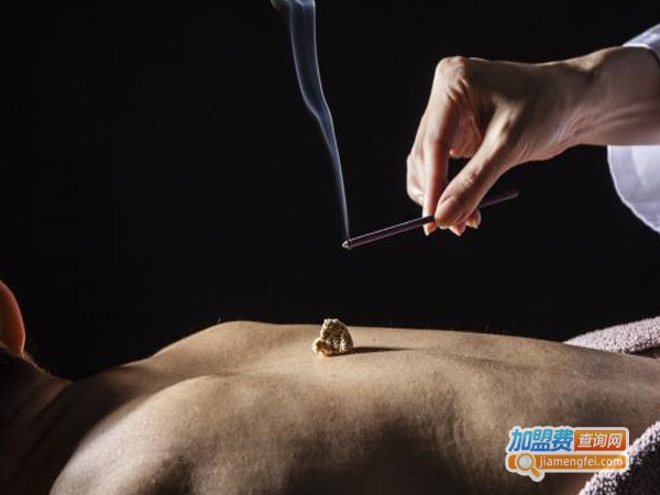 艾灸理疗馆加盟费