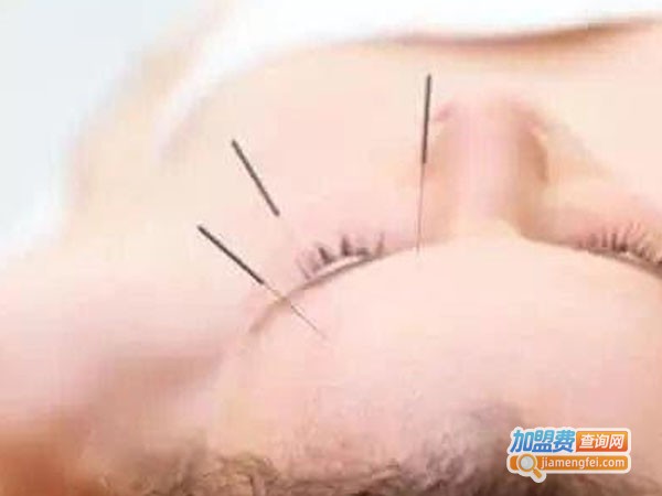 中医治疗近视加盟费