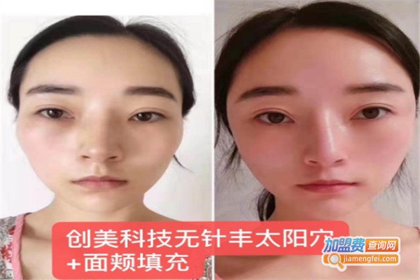 佐尔创美