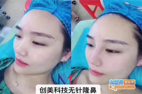 佐尔创美