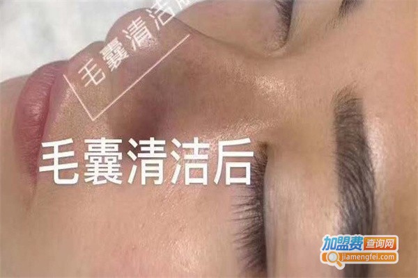 八叶莲华毛囊清洁