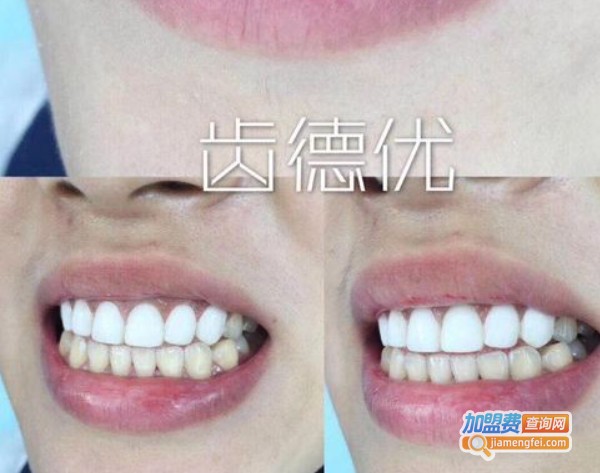 齿德优加盟费