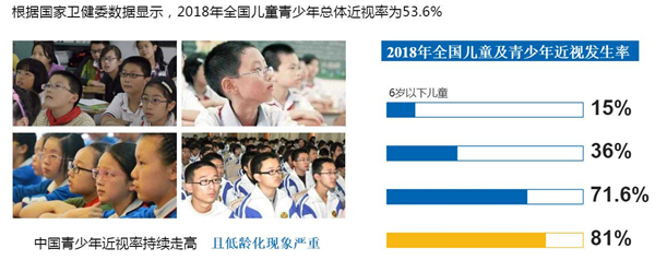 舒视鹰加盟
