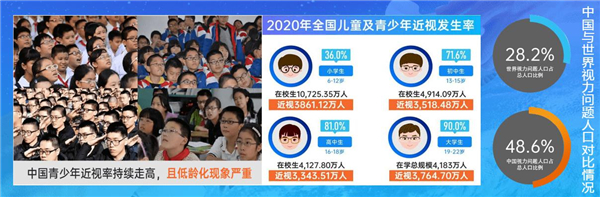 舒视鹰加盟