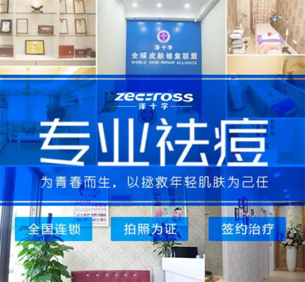泽十字祛痘加盟