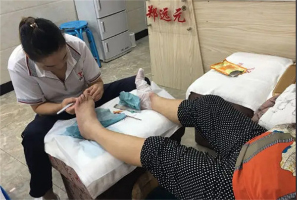 郑远元专业修脚店加盟费多少?