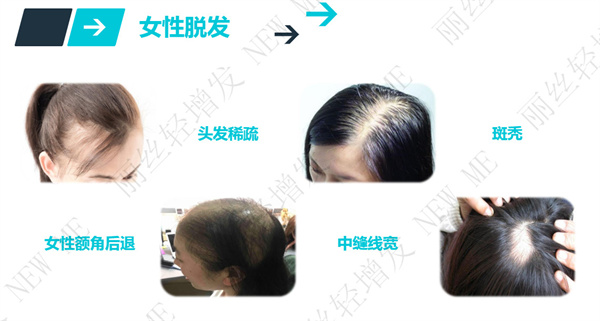丽丝轻增发