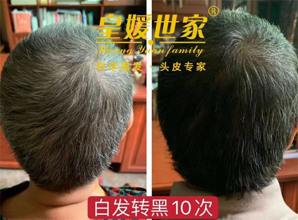 皇媛世家白转黑加盟