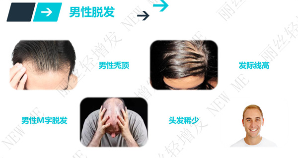 丽丝轻增发