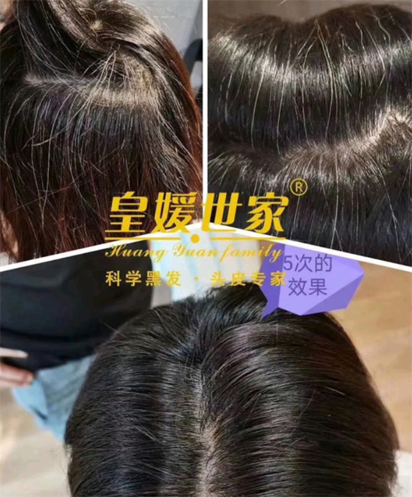 皇媛世家白转黑加盟