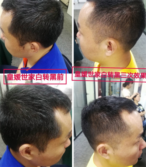 皇媛世家白转黑加盟
