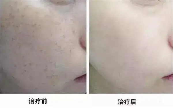 美诗颜泊草玉方祛斑加盟