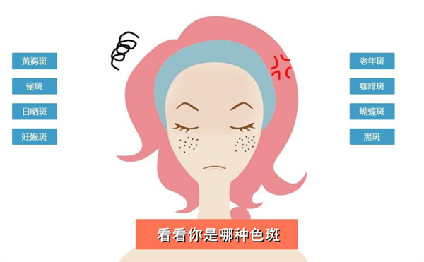 斑美宜祛斑加盟