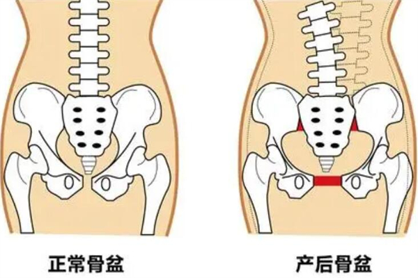 产后恢复加盟费