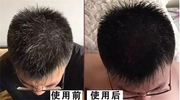 本逸养发馆加盟