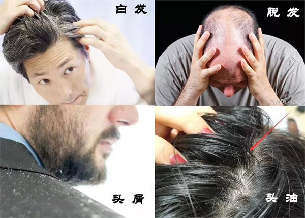 君丝佳头疗养发加盟