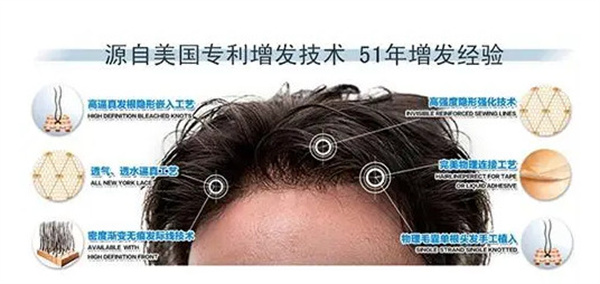 黑黛增发加盟