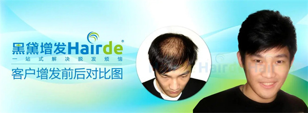 黑黛增发加盟