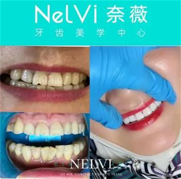 奈薇牙齿美学中心加盟