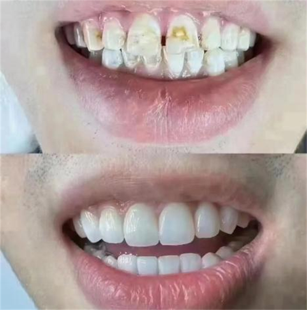奈薇牙齿美学中心加盟