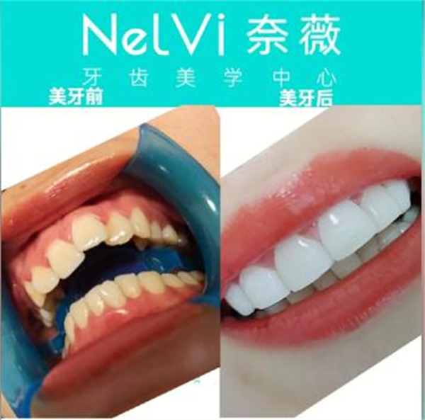 奈薇牙齿美学中心加盟