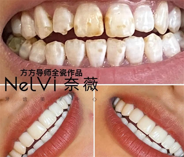 奈薇牙齿美学中心加盟