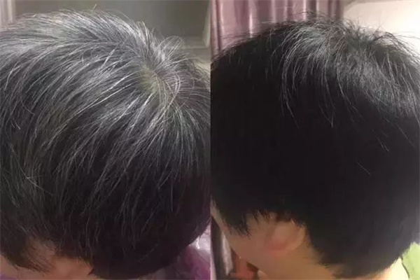 膜玲珑白发变黑发加盟