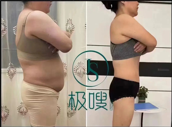 极嗖芯片减肥加盟