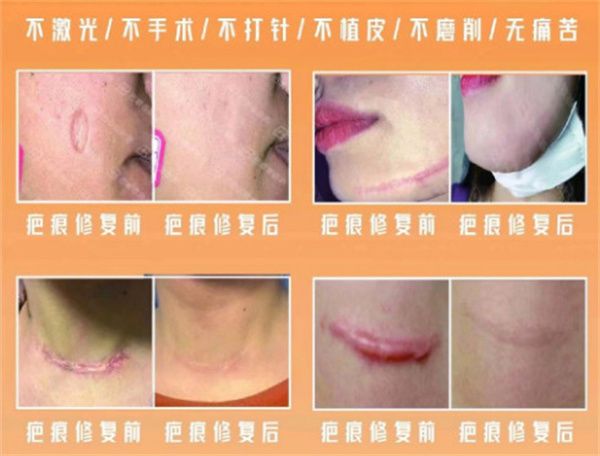 巴敏荟除疤公司介绍
