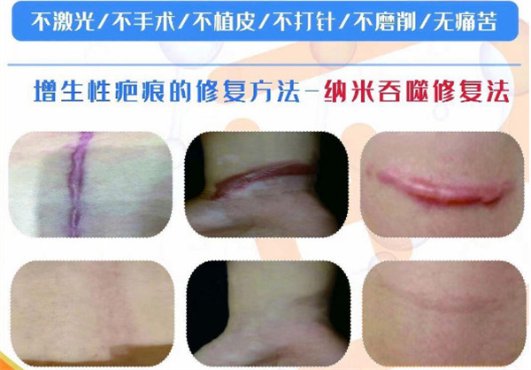 巴敏荟除疤公司介绍