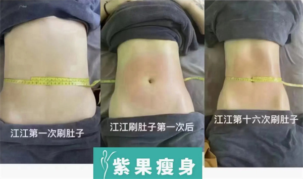 紫果瘦身加盟