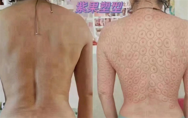 紫果瘦身加盟