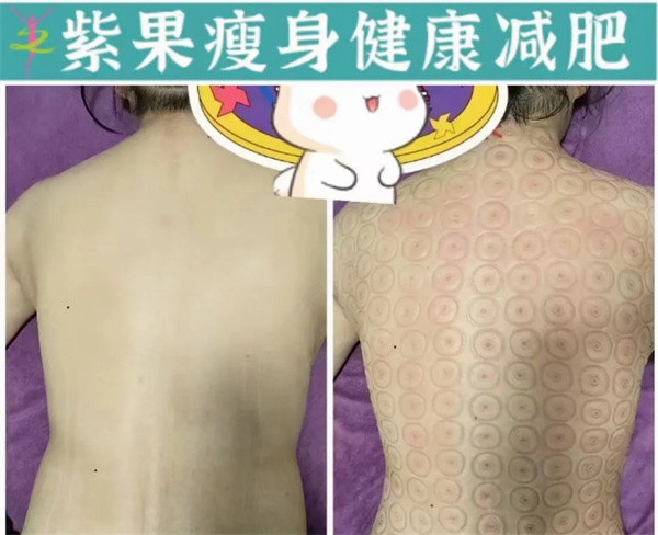 紫果瘦身加盟