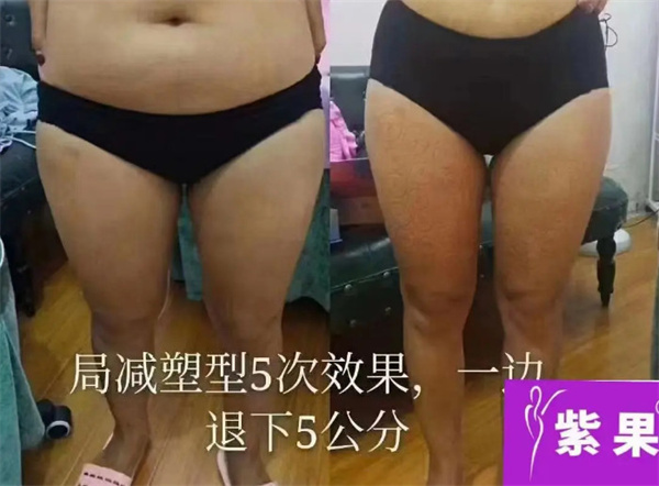 紫果瘦身加盟