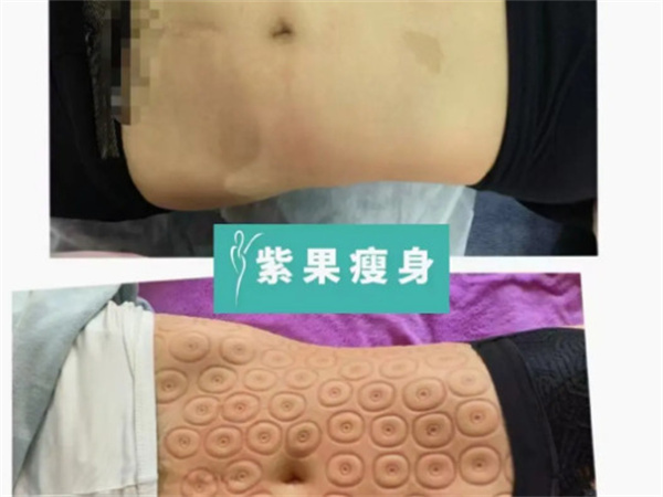 紫果瘦身加盟